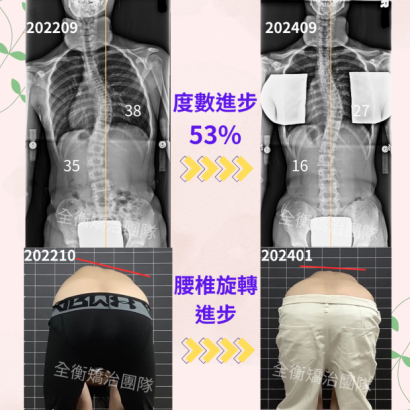 診所案例分享62 - 6627林芷彤.png