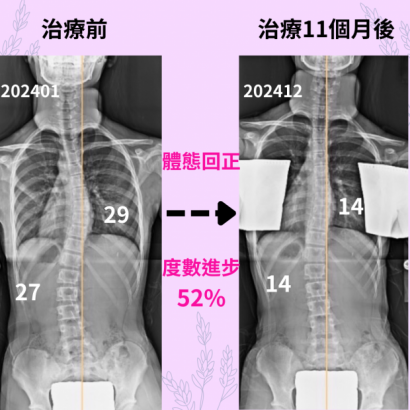 診所案例分享65 - 7402吳岳臻.png